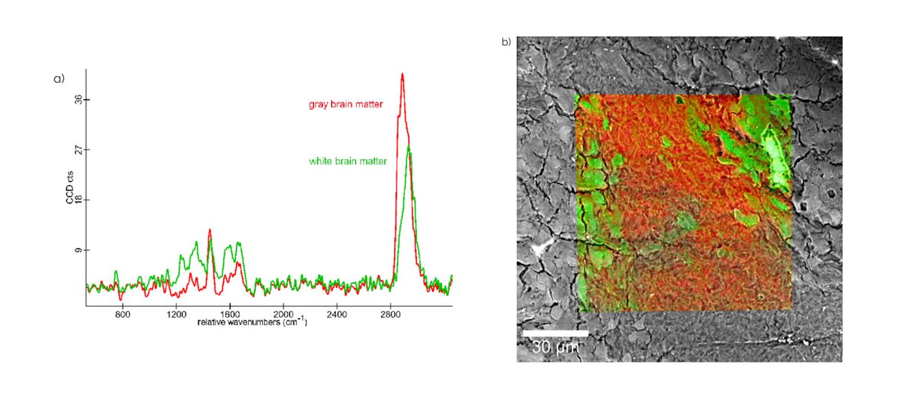Fig 3.In the color coded Raman image the white brain matter is shown in Green