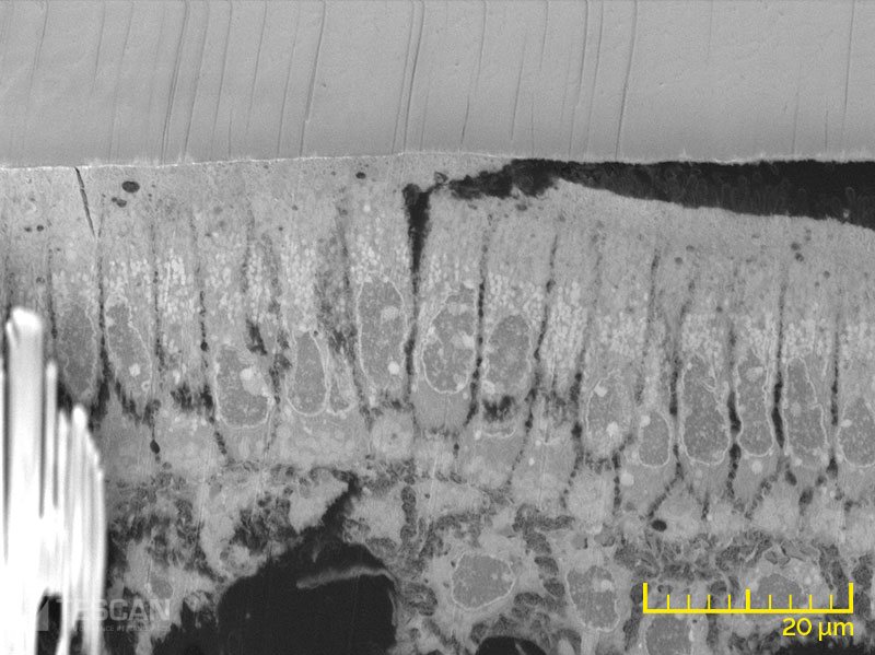 Osteoblast layer in a mouse tooth (chụp bằng Kính hiển vi điện tử quét SEM, FIB-SEM TESCAN)