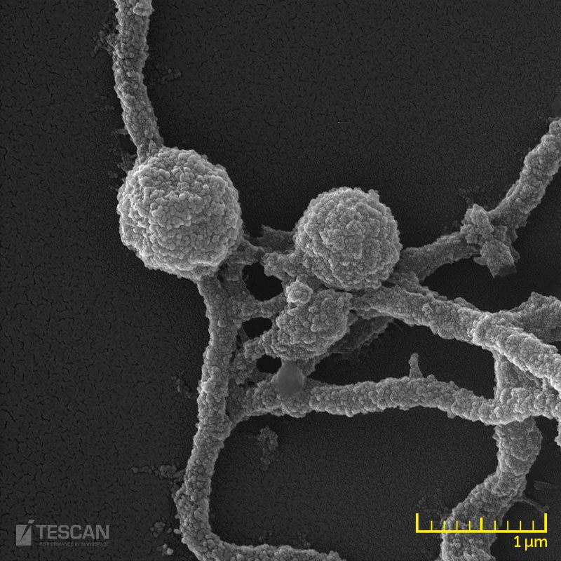 Microphotograph of Borrelia spp (chụp bởi Kính hiển vi điện tử quét SEM TESCAN)
